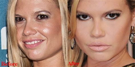 chanel west coast fake lips|is chanel west coast transformation.